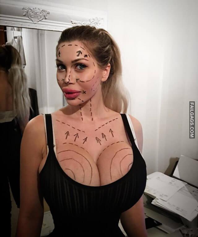 Model Pixee Fox Had 200 Surgeries to Become a Living Cartoon 